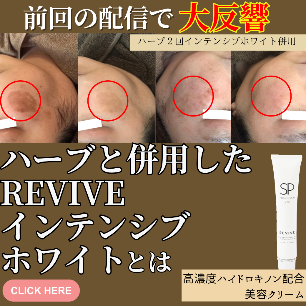 シミ全滅への近道？！ REVIVEインテンシブホワイトとは？？ - 美容 
