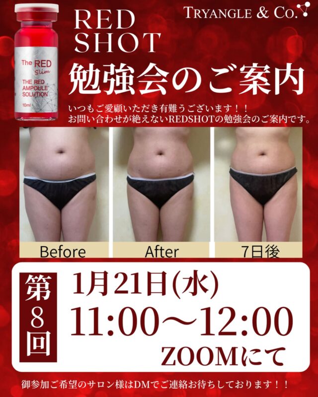 シミ全滅への近道？！ REVIVEインテンシブホワイトとは？？ | 美容